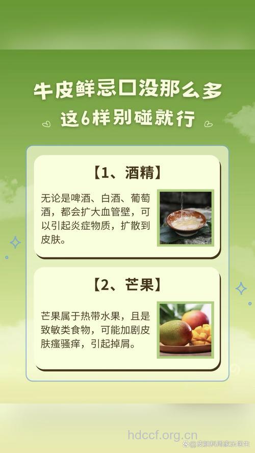 牛皮癣患者是不是一点酒都不能喝