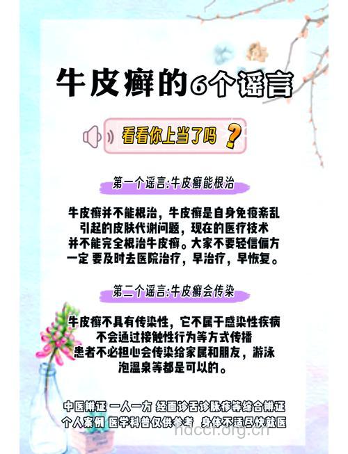不要走进牛皮癣治疗中的误区