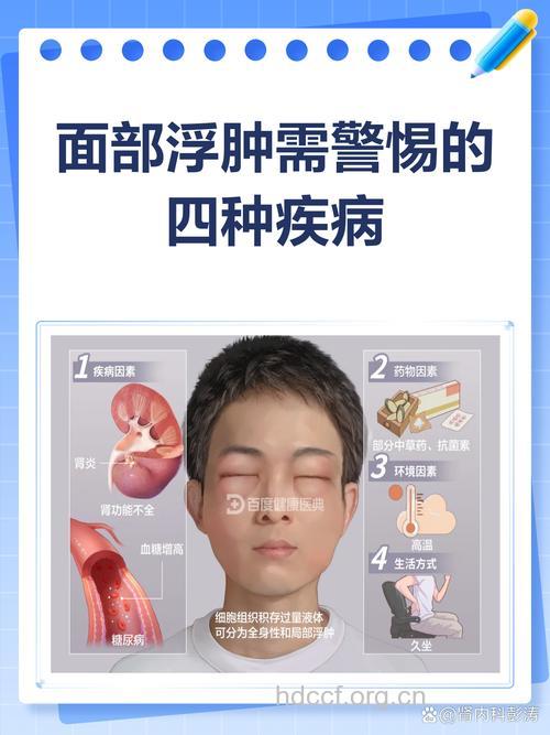 牛皮癣患者面部浮肿的病因及治疗方法