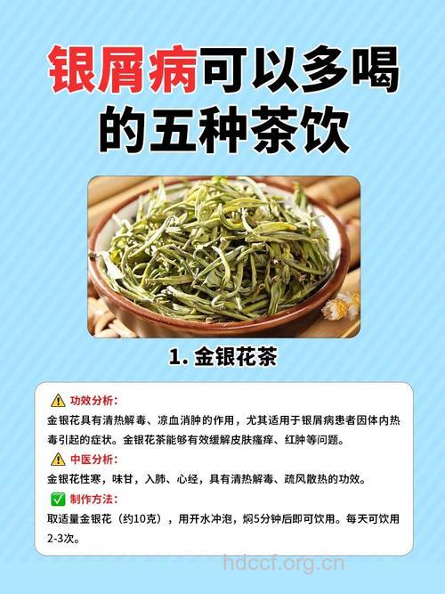 牛皮癣患者平时可以多喝点绿茶