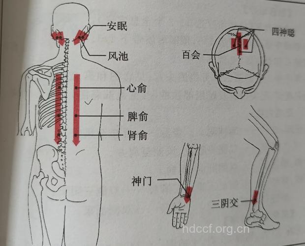 刮痧能治失眠少寐吗 失眠少寐的刮痧疗法
