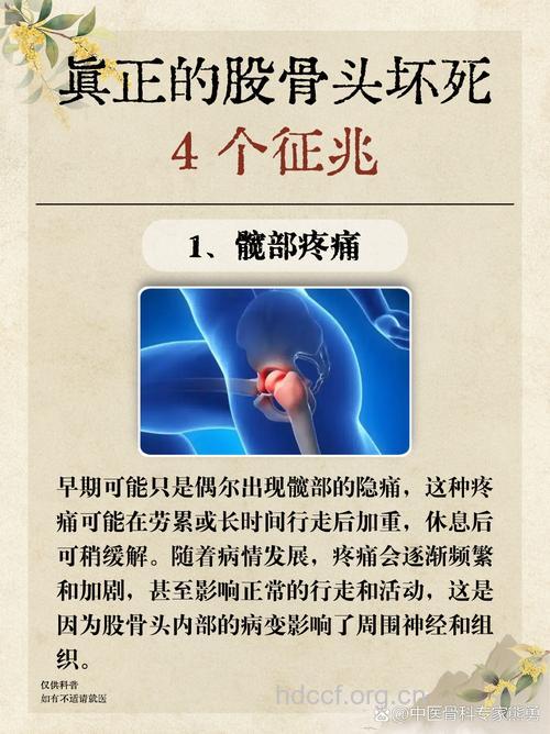 股骨头坏死有哪些临床表现