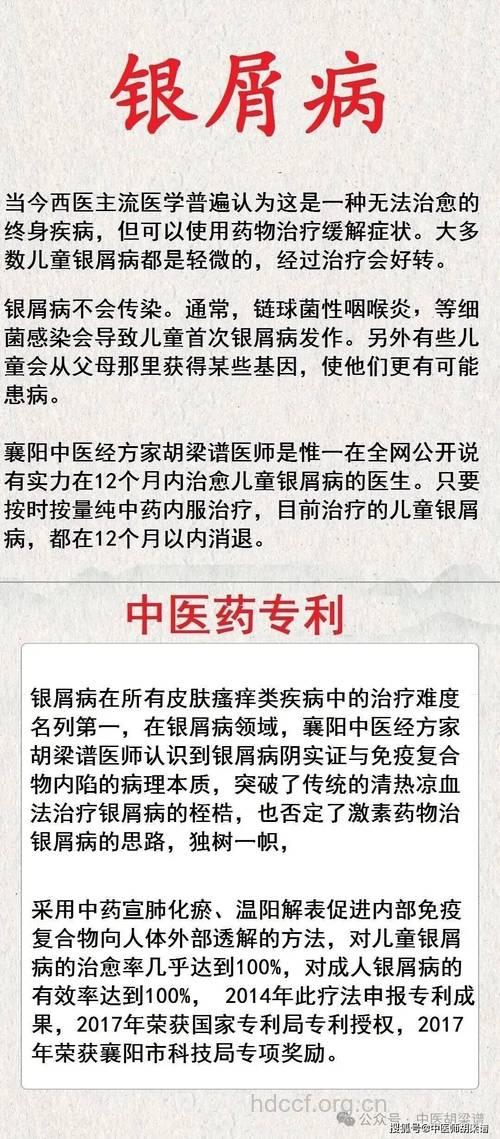 过量饮酒对牛皮癣的危害