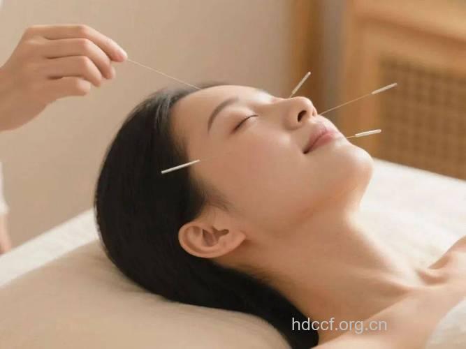 气色不好 针灸5个穴位能美容