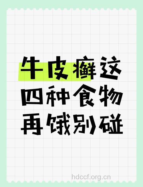 牛皮癣患者为什么吃面条好