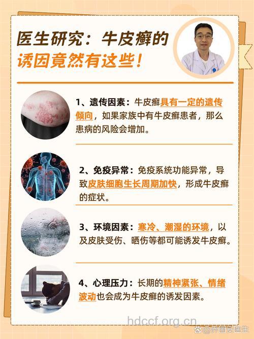 影响关节炎型牛皮癣发病的环境因素