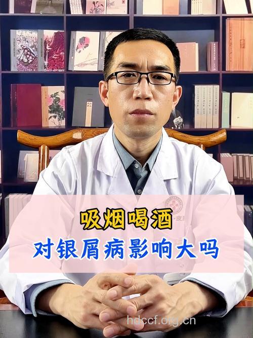 牛皮癣患者可以抽烟喝酒吗