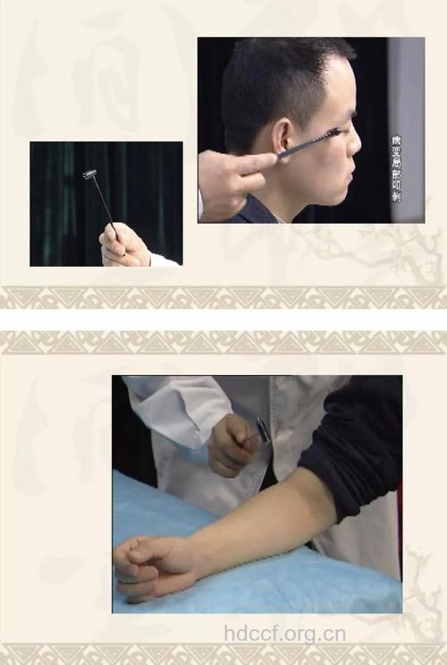 梅花针叩刺法 叩刺法的使用方法