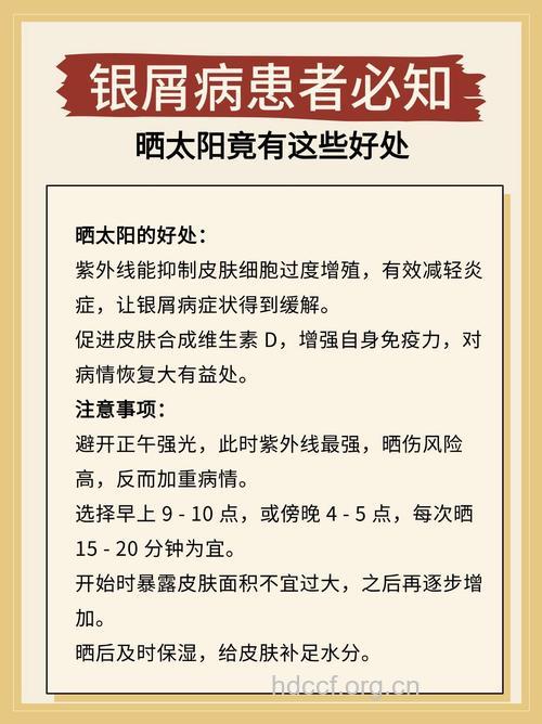 晒太阳对银屑病患者有益