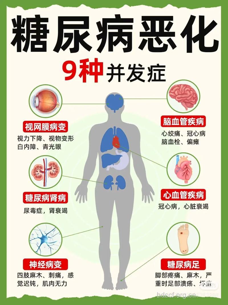 糖尿病会引发直肠癌吗