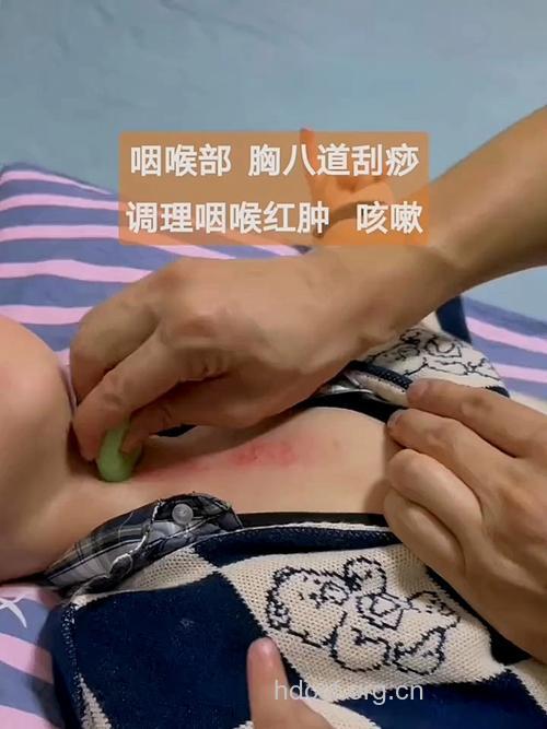 咽喉炎可以刮痧吗 刮痧治疗咽喉炎的方法