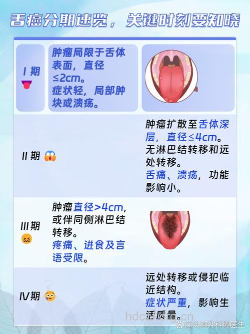 舌癌致癌因素是什么