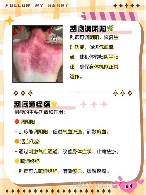 颈部刮痧的作用 颈部刮痧有2个好处