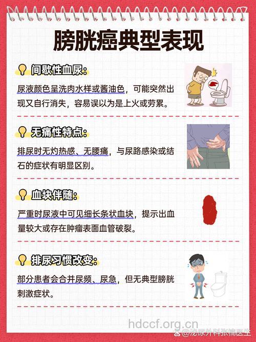 无痛性血尿是膀胱癌的信号吗