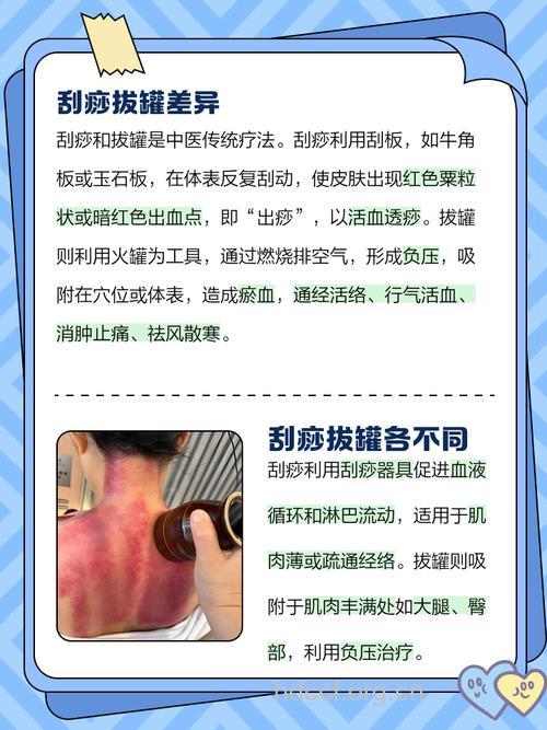 刮痧和拔罐的区别 刮痧与拔罐有什么区别