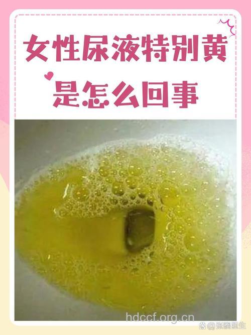 女性不可轻视尿黄