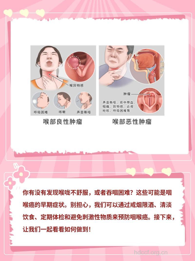 三点帮你早期发现喉癌