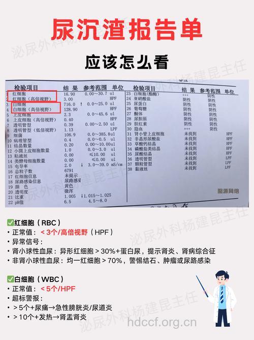 尿常规检查结果异常的原因