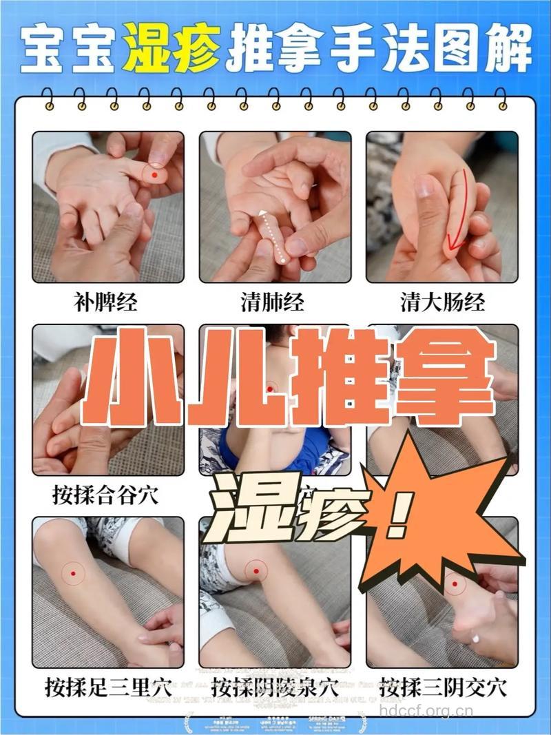 中医推拿治疗小儿湿疹