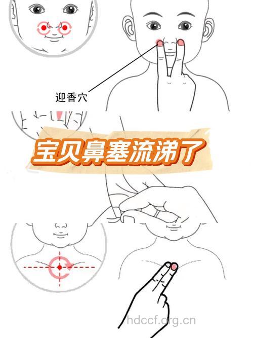 中医推拿治疗小儿鼻窦炎