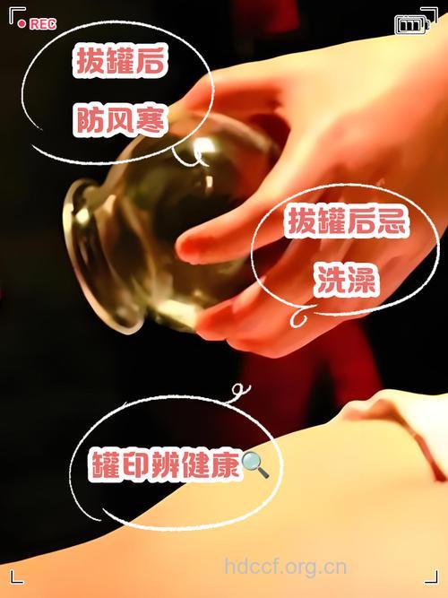 拔火罐后能吹空调吗 拔火罐后切记别受凉
