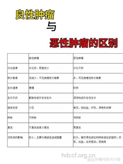 良性肿瘤和恶性肿瘤如何分别