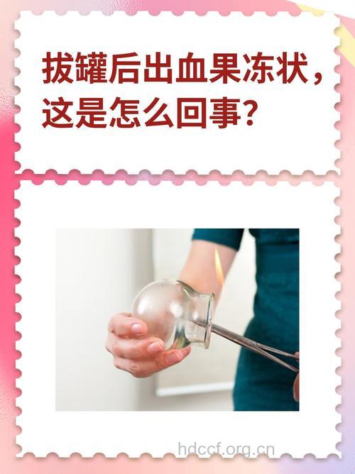 拔火罐出血的原因 从拔火罐出血看身体疾病