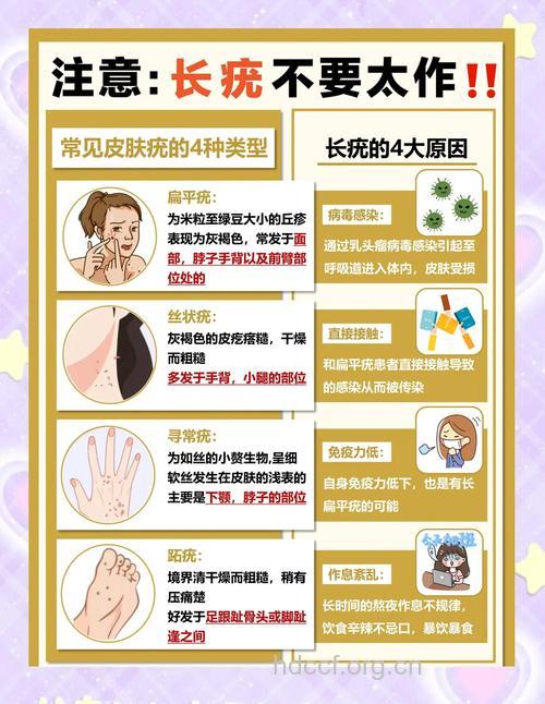 夏季常见的扁平疣治疗误区