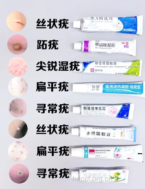 扁平疣可以治愈吗