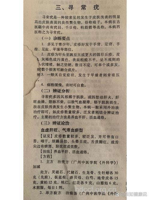 病例解析:艾炷灸治疗寻常疣