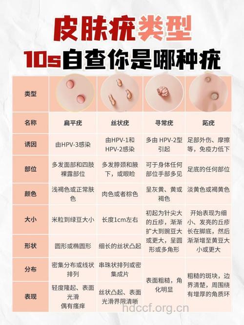 如何区分扁平疣与老年疣？