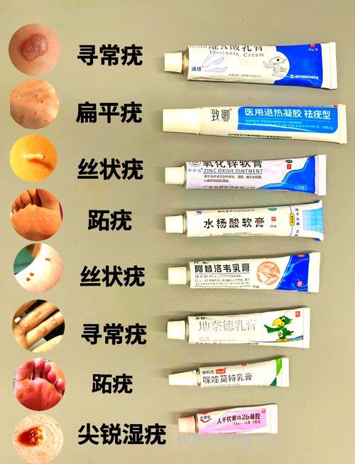 五大食疗方让你远离寻常疣