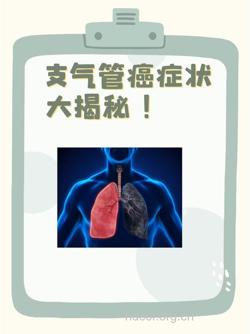 气管肿瘤症状似哮喘