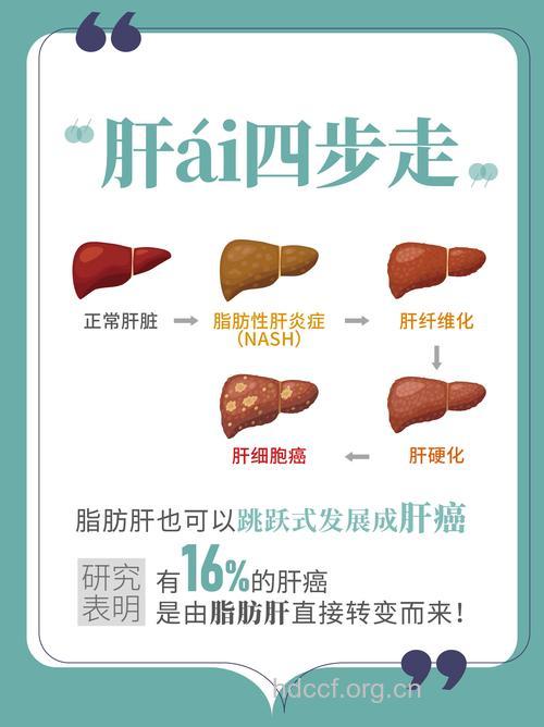 多少脂肪肝即变肝癌？