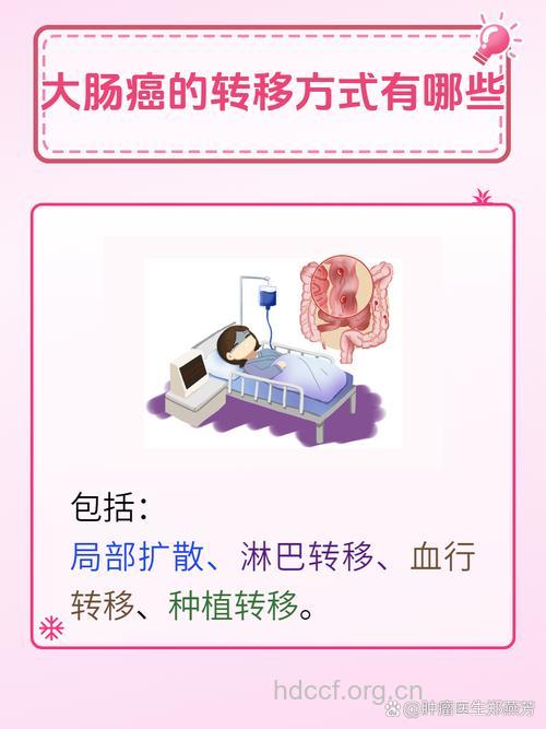 大肠癌有多少转移方式?