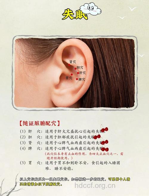 贴耳穴治疗失眠的常见方法