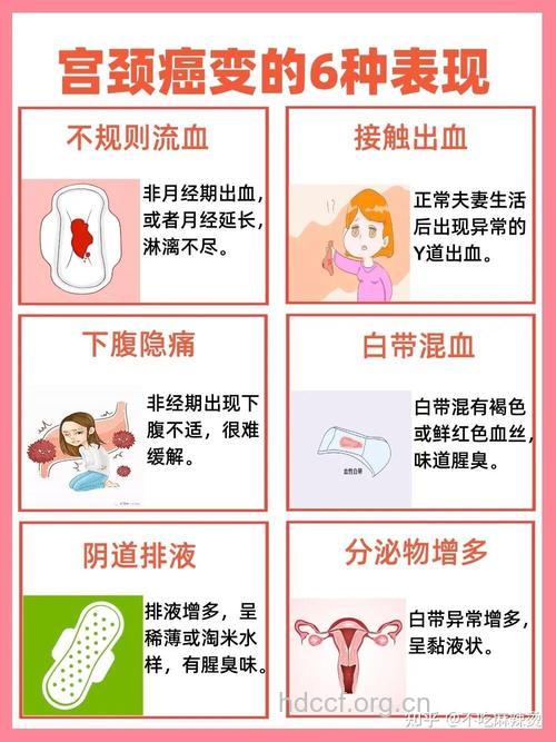 哪些妇科病容易会癌变