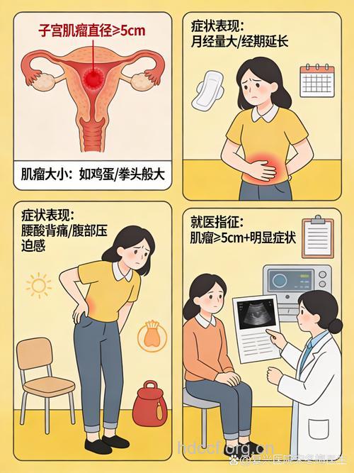 子宫肌瘤症状表现有哪些