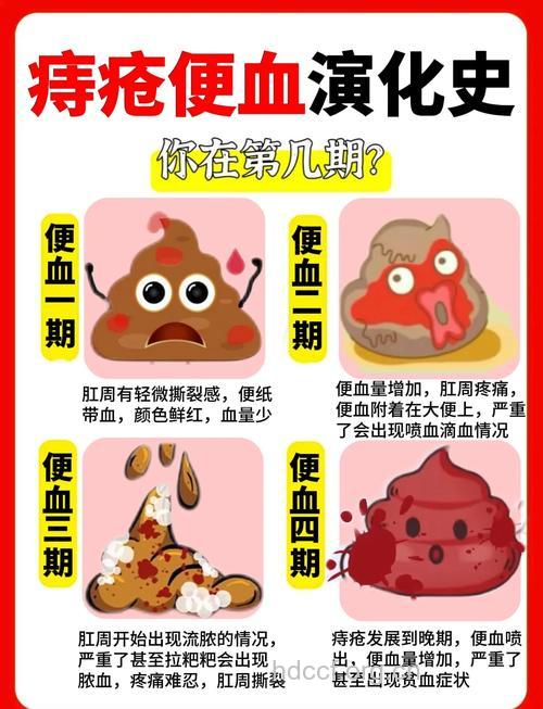 血便真假难辨 血便怎么办