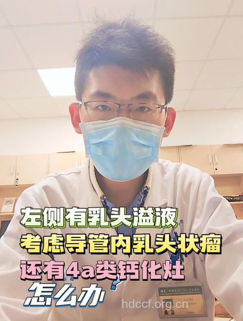 乳头溢液,考虑乳腺导管乳头状瘤