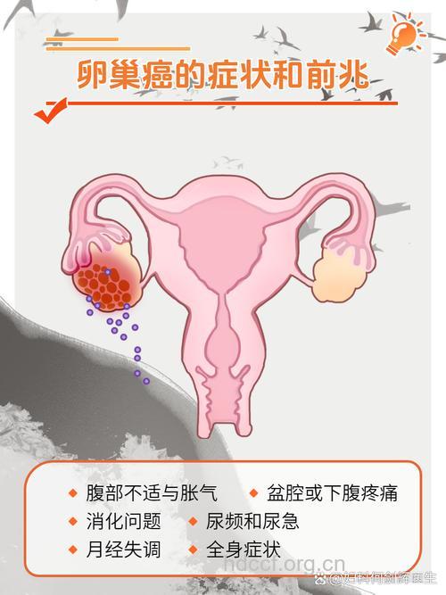 哪些女性易得卵巢癌?