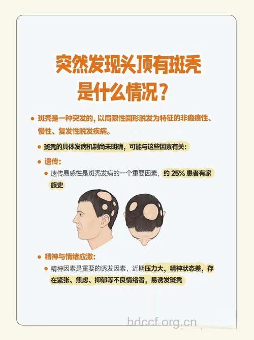 为什么会发生斑秃