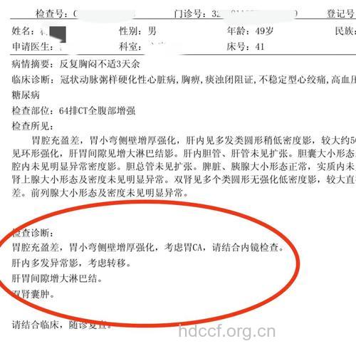 确诊胃癌该做哪些检查?