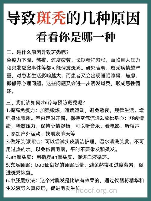 斑秃日常有什么保健原则