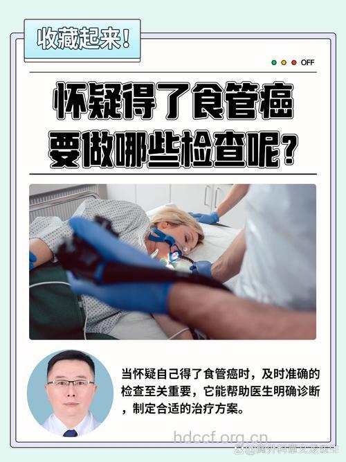 确诊食管癌需做哪些检查?