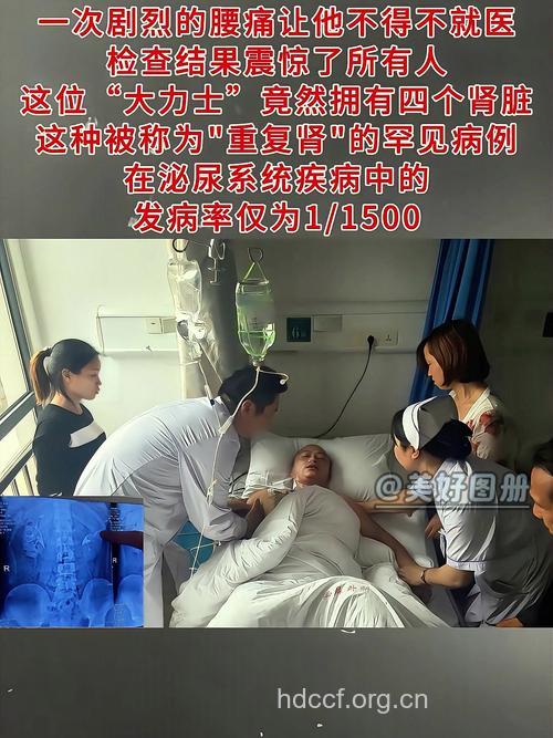 惊！6旬老人竟长4个肾