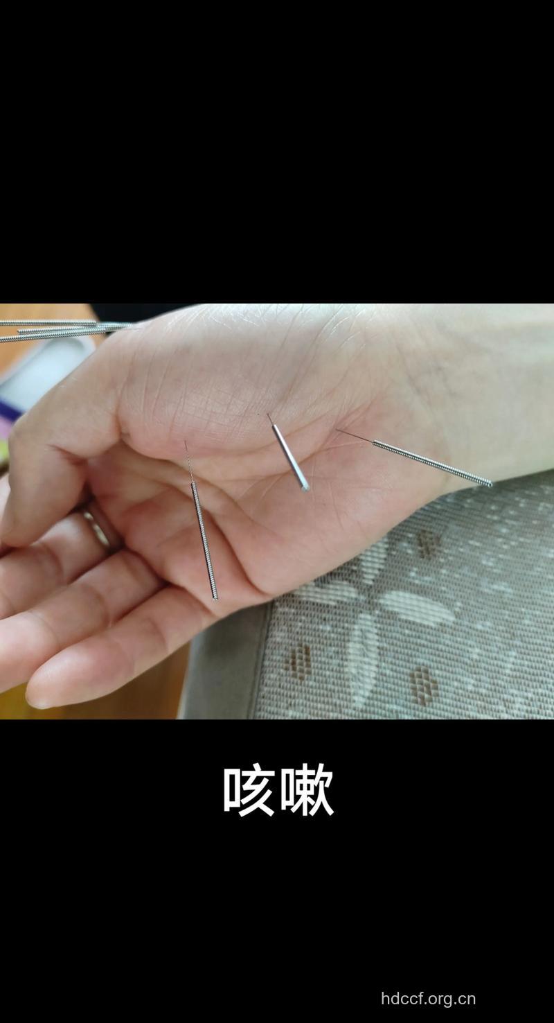 秋季感冒的针灸疗法