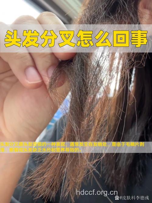 多吃豆类预防头发断裂分叉