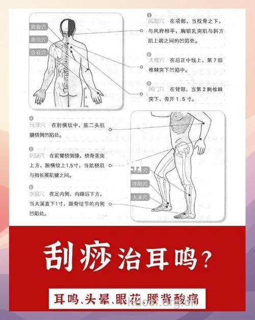 刮痧能治疗耳鸣吗