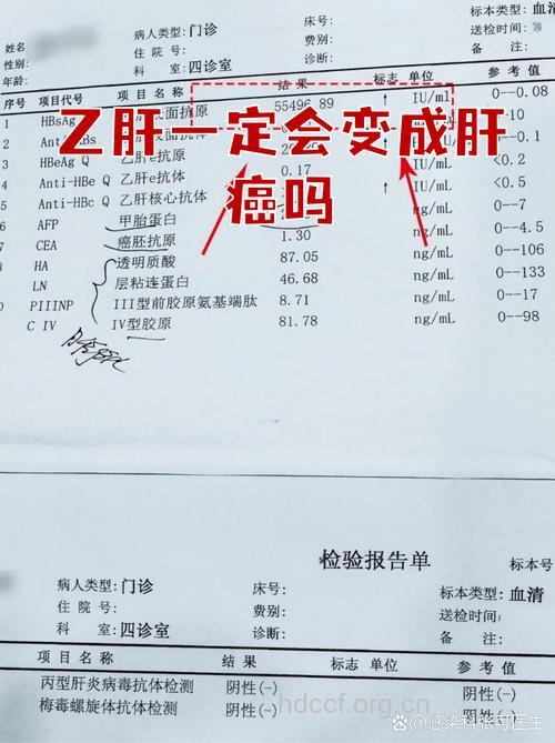 乙型肝炎会转变成肝癌吗?